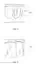 Fig. 07 - Orthodontic aligner fabrication by overlay method
