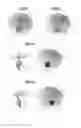 Fig. 03 - Selection of optimal viewing angle to optimize anatomy visibility and patient skin dose