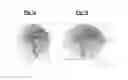 Fig. 04 - Selection of optimal viewing angle to optimize anatomy visibility and patient skin dose