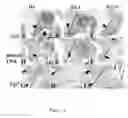Fig. 04 - NON-SURGICAL APPROACH TO PREVENT AND CORRECT CRANIOFACIAL MALFORMATIONS DURING DEVELOPMENT