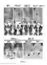 Fig. 06 - NON-SURGICAL APPROACH TO PREVENT AND CORRECT CRANIOFACIAL MALFORMATIONS DURING DEVELOPMENT