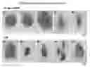 Fig. 01 - Insect pest control method