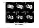 Fig. 08 - Method for measuring the force interaction that is caused by a sample