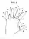 Fig. 04 - Finger jacket