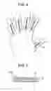 Fig. 05 - Finger jacket