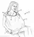 Fig. 01 - Nursing cover-up