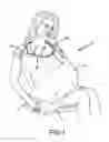 Fig. 02 - Nursing cover-up