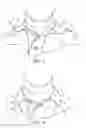 Fig. 06 - Garment stiffener packaging arrangement, assembly, and methods