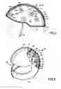 Fig. 02 - Liquid-gel impact reaction liner
