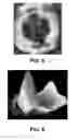 Fig. 05 - Joint arthroplasty devices and surgical tools