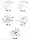 Fig. 08 - Joint arthroplasty devices and surgical tools
