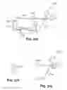 Fig. 34 - Joint arthroplasty devices and surgical tools