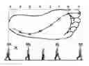 Fig. 01 - INSOLE FOR SHOES