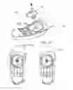 Fig. 08 - Adjustable forefoot posting for orthotic