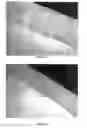 Fig. 06 - PROTECTIVE SYSTEM FOR LEACHING POLYCRYSTALLINE DIAMOND ELEMENTS