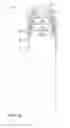Fig. 08 - Methods and apparatus for mast system with enhanced load bearing