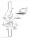 Fig. 01 - Small form factor medical sensor structure and method therefor