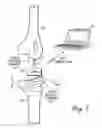 Fig. 02 - Small form factor medical sensor structure and method therefor
