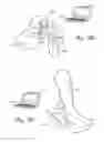 Fig. 18 - Small form factor medical sensor structure and method therefor