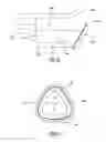 Fig. 04 - TREATMENT LADLE