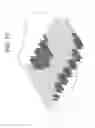 Fig. 11 - Tufting machine for producing a precise graphic design