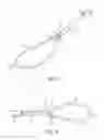 Fig. 08 - Docking aid apparatus with utility implement