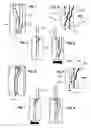 Fig. 02 - Device for adjusting a camshaft of an internal combustion engine