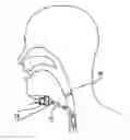 Fig. 01 - Low profile heat and moisture exchanger device for tracheotomy and speaking valve