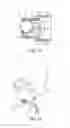 Fig. 07 - Low profile heat and moisture exchanger device for tracheotomy and speaking valve