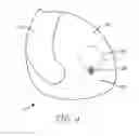 Fig. 05 - Dry powder inhaler dose counters