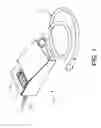 Fig. 02 - Vaporizer heating assembly