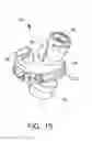 Fig. 13 - Respiratory access port assembly with push button lock and method of use