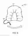 Fig. 06 - Hand and forearm elevation device and methods of use