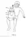 Fig. 08 - Hand and forearm elevation device and methods of use