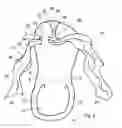 Fig. 03 - Pedicure Slipper with Toe Separator and Method