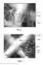 Fig. 08 - Method for removal of beryllium contamination from an article