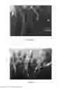 Fig. 14 - Method for removal of beryllium contamination from an article