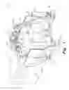 Fig. 02 - Vehicle snow removal system