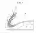Fig. 02 - Run-flat tire