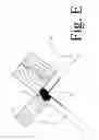 Fig. 06 - Rotational application device for the adherence of bridging materials in angular applications