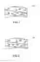 Fig. 02 - Brake Pad Assembly with Embedded Shim