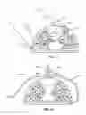 Fig. 14 - Submerged system and method for removal of undesirable substances from aqueous media
