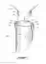 Fig. 02 - REMOVABLE SPOUT FOR A HOPPER