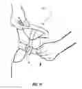 Fig. 09 - Concealable Pouch