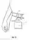 Fig. 10 - Concealable Pouch