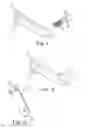 Fig. 09 - Retractable lanyard