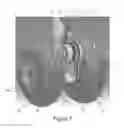 Fig. 02 - Aircraft landing gear