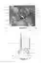 Fig. 04 - Aircraft landing gear