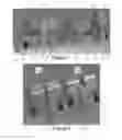 Fig. 06 - Aircraft landing gear
