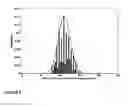Fig. 07 - Radiation measurement using timing-over-ethernet protocol